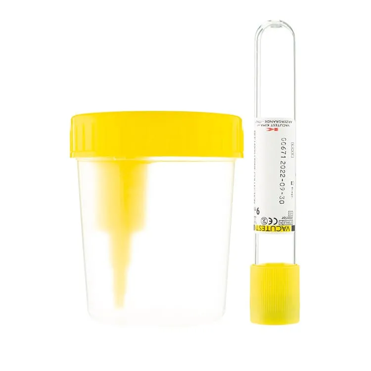 Aposán Kit (Envase + Tubo) para Recogida de Muestras de Orina 100 ml, 1 Unidad Aposan-Kit-Envase-Tubo-Recogida-Muestras-de-Orina